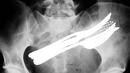 Безумията, които рентгеновият апарат е уловил в човешкото тяло