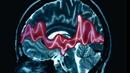 Един на 200 българи заболява от епилепсия