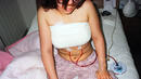 Брутални снимки на жени, подложили се на пластични операции