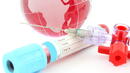 Не една, две ваксини срещу СПИН изобретиха руснаците