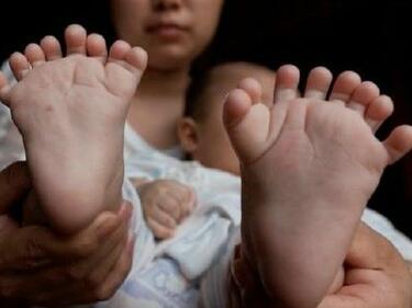 В Китай се роди момченце с 31 пръста
