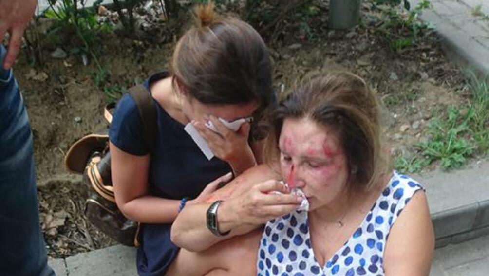 Маскирани мъже пребиха две жени в Борисовата градина в София.