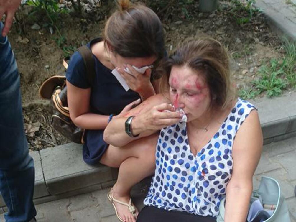 Нотариус Валентина Механджийска и дъщеря ѝ Мира които бяха пребити в понеделник следобя
