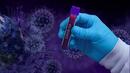Рекорден брой положителни проби за коронавирус в Гърция
