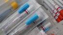 Все повече европейски страни затягат ограниченията заради втората вълна от коронавирус
