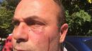 Роми нападнаха екип журналисти в Самоков