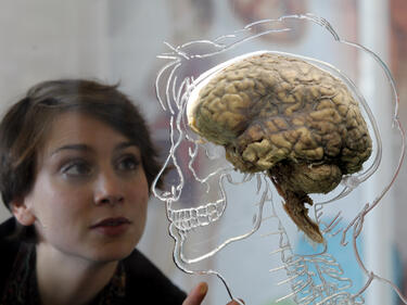 Подгответе мозъчния скенер за Свети Валентин 