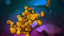 Първи смъртен случай от коронавирус в Испания

