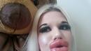 СНИМКИ: Вижте как изглежда живото бургаско Барби Андреа след 22-ото подобрение на устните