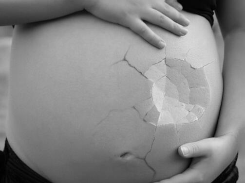 Най общо казано абортът представлява прекъсване на бременност Когато се случва