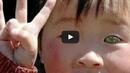 В Китай се роди дете мутант с очи като на котка (ВИДЕО)

