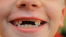 Здрави ли са зъбите на децата ни?