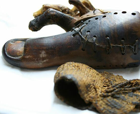 Най-старата протеза - на 3000 години
