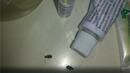 Ужас! Инфекциозна клиника във Варна гъмжи от хлебарки и мухъл 