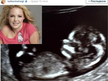 Катрин Хейгъл бременна, показа снимка на ембриона