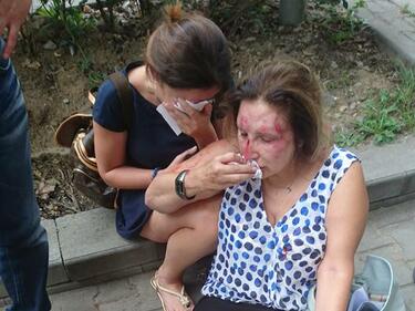 Маскирани пребиха две жени нотариуси в Борисовата градина (СНИМКИ)