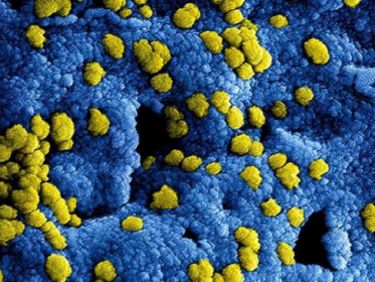 Глобална пандемия на новия коронавирус прогнозират експерти