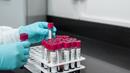 В Плевен започват изследвания за Covid-19 с PCR тестовете
