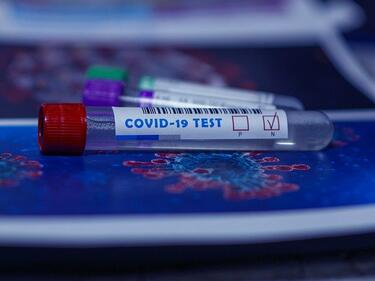 158 нови случая на коронавирус за последното денонощие