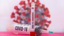 COVID-19 взима повече жертви заради пика на заразени в средата на юли