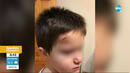 Забит молив в челото: Родители пропищяха от проблемни близнаци в детска градина
