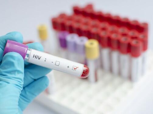40 години от обявяването на ХИВ пандемията в света