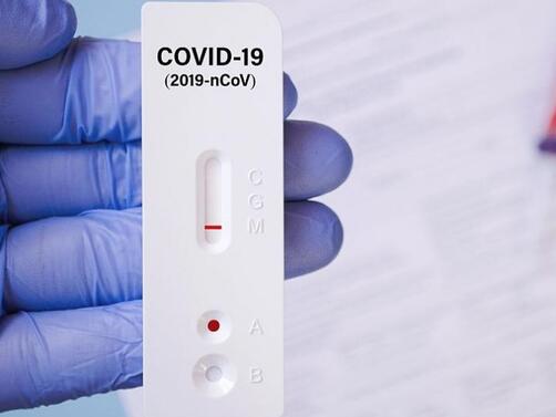 Новите потвърдени случаи на коронавирус  у нас за последното денонощие
