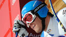 Световен шампион по ски падна лошо на тренировка