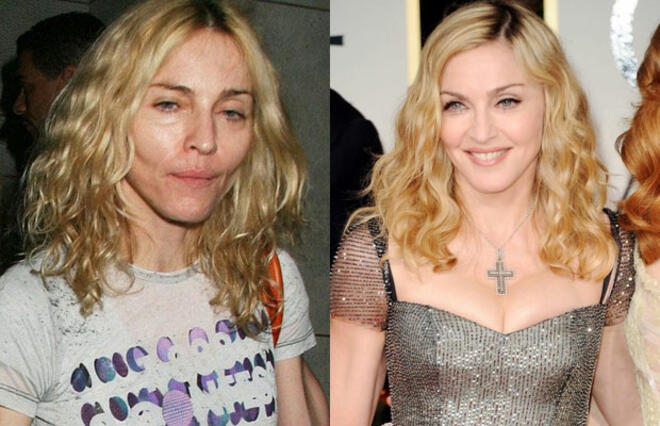 Madonna