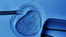 Нова техника "избира" най-успешния ембрион за ин витро