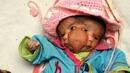 Индийци се кланят на бебе с две лица (18+)