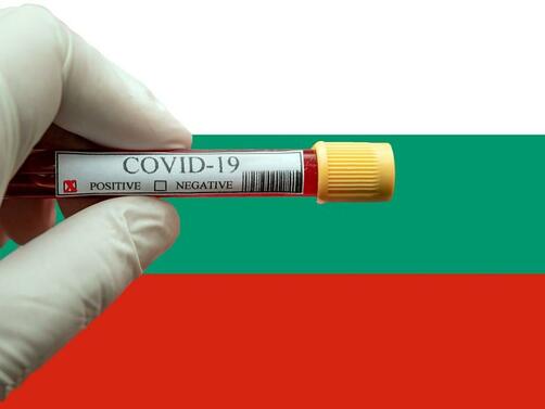 Новите случаи на COVID-19 у нас за последното денонощие са