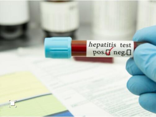 Нов вид хепатит който разболява сериозно деца притесни здравните власти