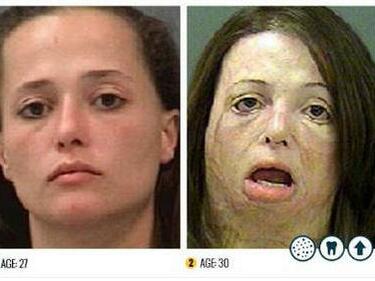 Ужасяващите снимки на наркомани преди и след адикцията (18+)