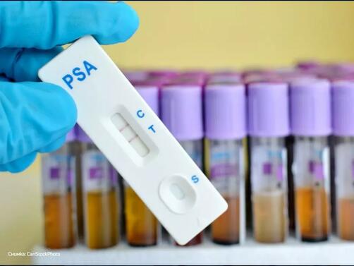 Министерството на здравеопазването предлага антигенните тестове за COVID-19 да са