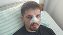 Бащата на пребитото 19-годишно момче в Плевен: Удрян е докато не изпада в безсъзнание