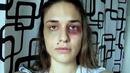 Жена илюстрира домашното насилие със снимка всеки ден