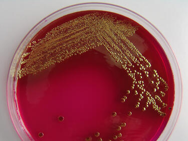 Европейските земеделски министри обсъждат ситуацията с E.coli